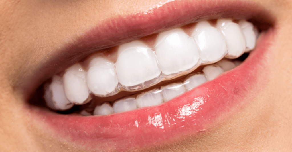 Tecnologia na Odontologia, Tecnologia na Odontologia: conheça 5 soluções inovadoras